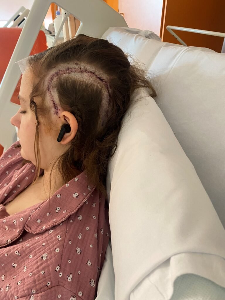 Warrington teenager becomes world’s youngest AVM patient to undergo awake brain surgery