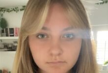 Warrington teenager becomes world’s youngest AVM patient to undergo awake brain surgery